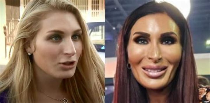 Net Worth, Plastic Surgery And Relationships Of Pierre Boo